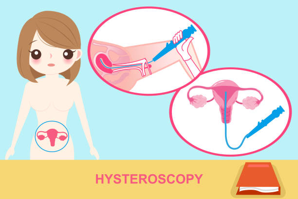 Hysteroscopy