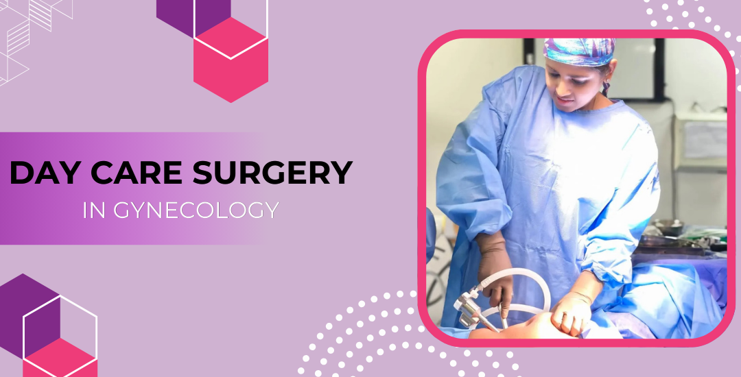 Day Care Surgery in Gynecology: A Modern Approach to Women’s Health