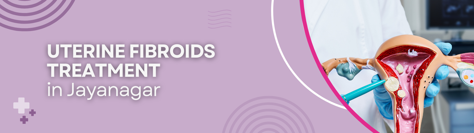 Uterine Fibroids Treatment Uterine Fibroids Treatment