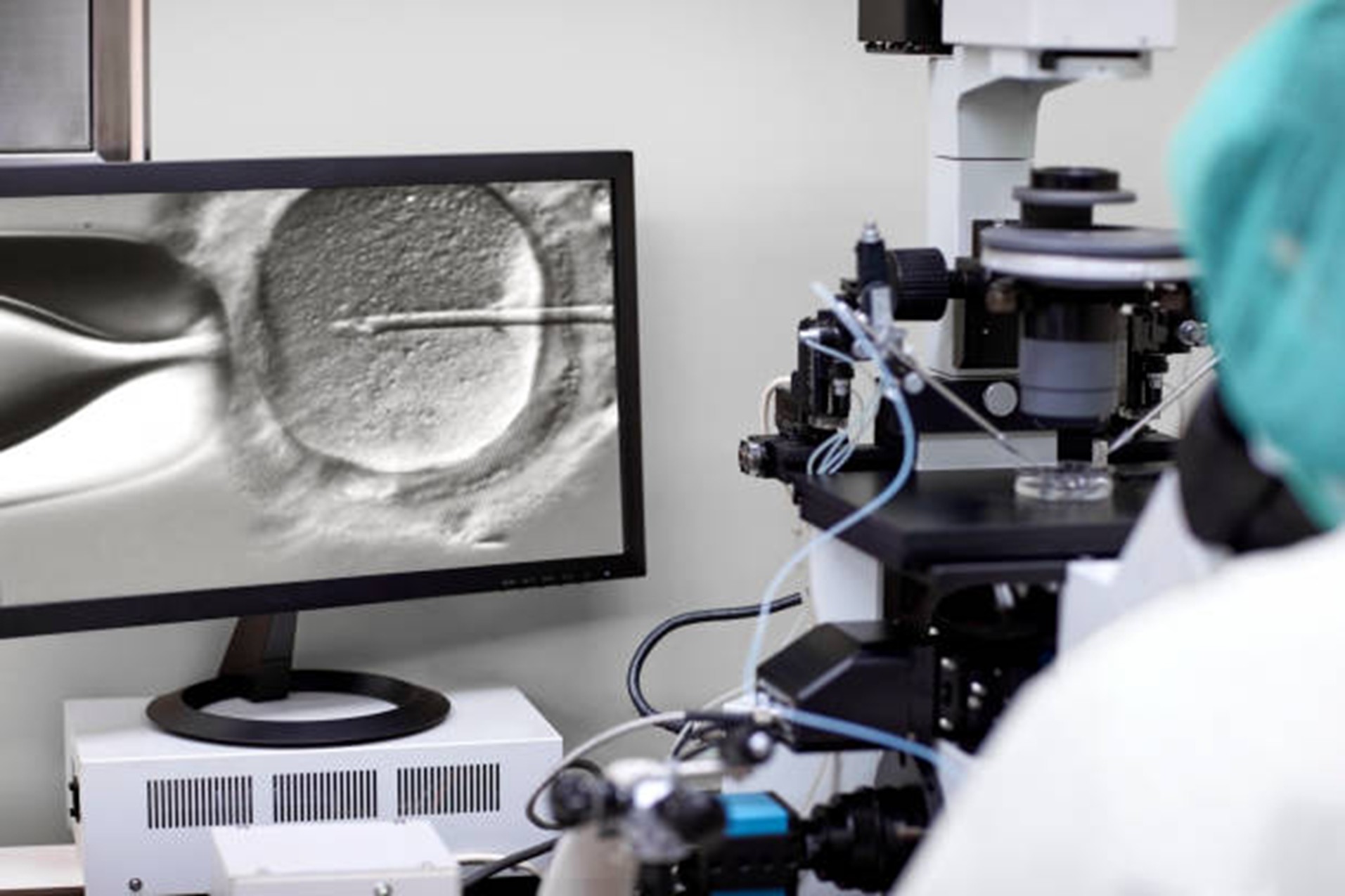 Why go for Follicular Monitoring Treatment?