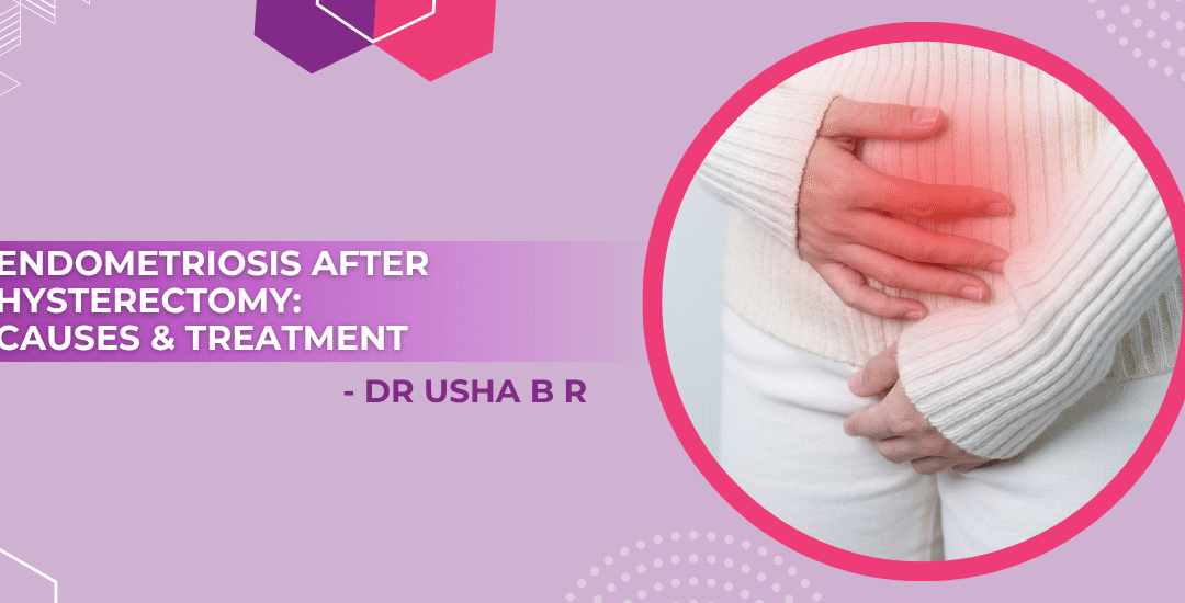 Endometriosis after Total Hysterectomy: Why Symptoms Can Persist and How to Treat Them